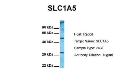 Western Blot: SLC1A5 Antibody [NBP1-59732]