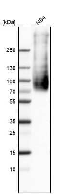 Western Blot: SLC1A5 Antibody [NBP1-89327]