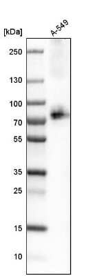 Western Blot: SLC1A5 Antibody [NBP1-89328]