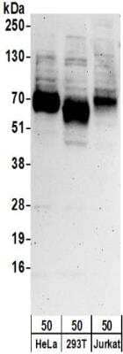 Western Blot: SLC1A5 Antibody [NBP2-32239]