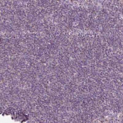 Immunohistochemistry-Paraffin: SLC1A7 Antibody [NBP2-13317]