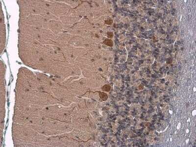 Immunohistochemistry-Paraffin: SLC1A7 Antibody [NBP3-13362]