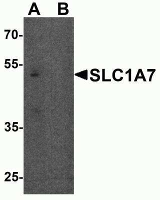 Western Blot: SLC1A7 AntibodyBSA Free [NBP2-81802]