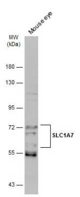 Western Blot: SLC1A7 Antibody [NBP3-13363]