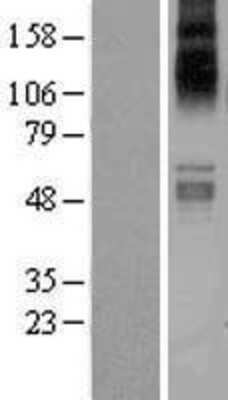 Western Blot: SLC1A7 Overexpression Lysate [NBP2-04316]