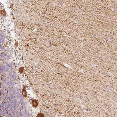 Immunohistochemistry: SLC20A1 Antibody [NBP2-38266]