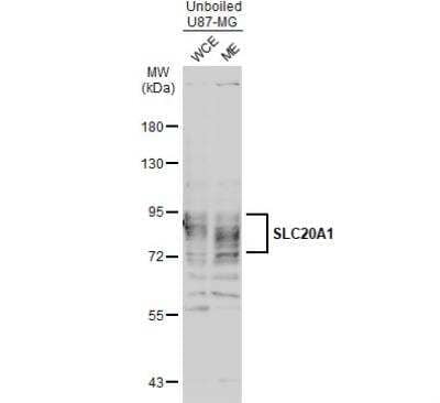 Western Blot: SLC20A1 Antibody [NBP1-32252]