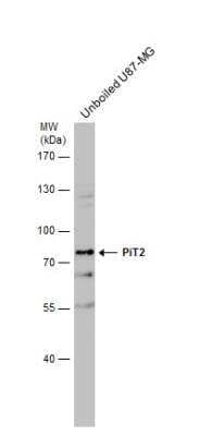 Western Blot: SLC20A2 Antibody [NBP1-32285]