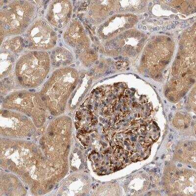 Immunohistochemistry: SLC22A1 Antibody [NBP1-89418]