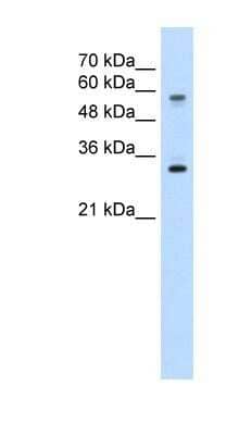 Western Blot: SLC22A1 Antibody [NBP1-59419]