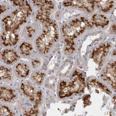 Immunohistochemistry-Paraffin: SLC22A11 Antibody [NBP1-82501]