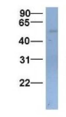 Western Blot: SLC22A11 Antibody [NBP1-69536]