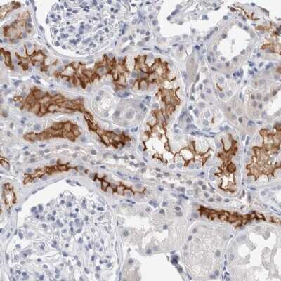 Immunohistochemistry-Paraffin: SLC22A12 Antibody [NBP1-82500]