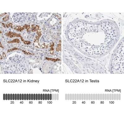 Immunohistochemistry-Paraffin: SLC22A12 Antibody [NBP1-82500]