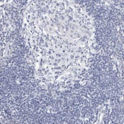 Immunohistochemistry-Paraffin: SLC22A12 Antibody [NBP1-82500]