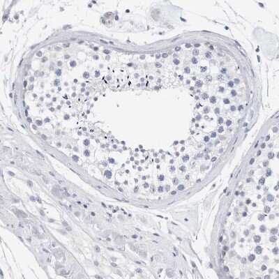 Immunohistochemistry-Paraffin: SLC22A12 Antibody [NBP1-82500]