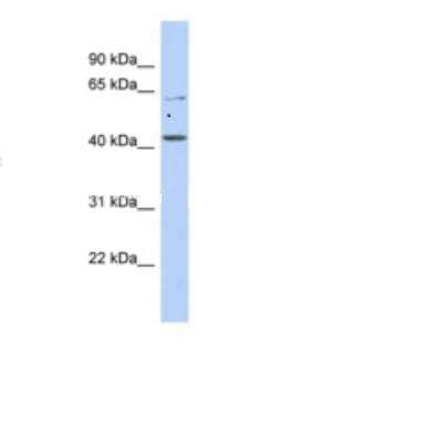 Western Blot: SLC22A12 Antibody [NBP1-69538]