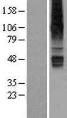 Western Blot: SLC22A12 Overexpression Lysate [NBL1-16031]