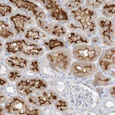 Immunohistochemistry-Paraffin: SLC22A13 Antibody [NBP2-32712]