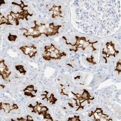 Immunohistochemistry-Paraffin: SLC22A13 Antibody [NBP1-82502]