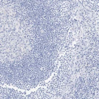 Immunohistochemistry-Paraffin: SLC22A13 Antibody [NBP1-82502]