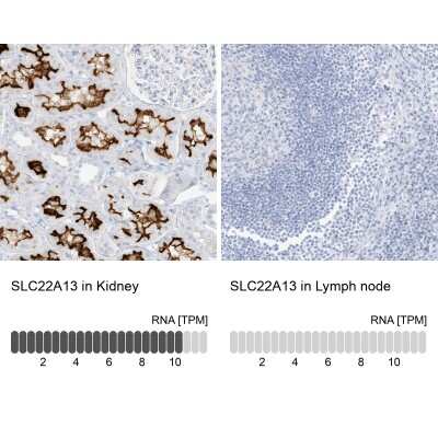 Immunohistochemistry-Paraffin: SLC22A13 Antibody [NBP1-82502]
