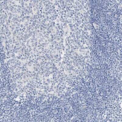 Immunohistochemistry-Paraffin: SLC22A13 Antibody [NBP2-32712]