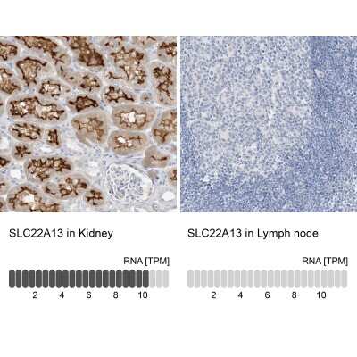 Immunohistochemistry-Paraffin: SLC22A13 Antibody [NBP2-32712]