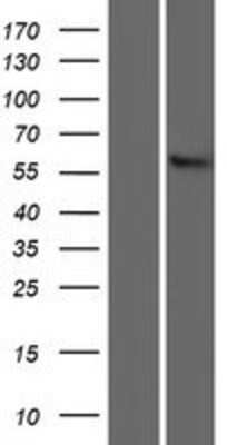 Western Blot: SLC22A13 Overexpression Lysate [NBP2-07894]