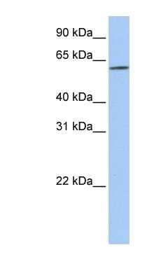 Western Blot: SLC22A14 Antibody [NBP1-59398]