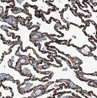 Immunohistochemistry-Paraffin: SLC22A15 Antibody [NBP1-84662]