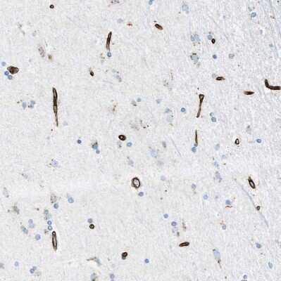 Immunohistochemistry-Paraffin: SLC22A15 Antibody [NBP1-84662]