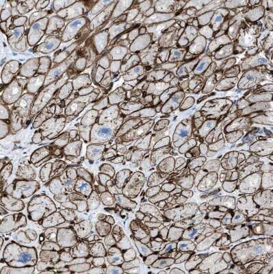 Immunohistochemistry-Paraffin: SLC22A15 Antibody [NBP1-84662]