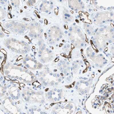 Immunohistochemistry-Paraffin: SLC22A15 Antibody [NBP1-84662]