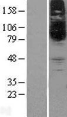 Western Blot: SLC22A15 Overexpression Lysate [NBP2-04373]