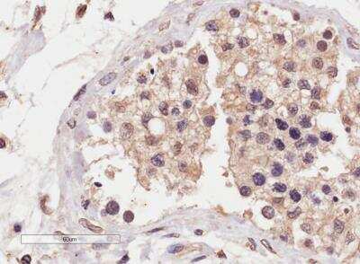 Immunohistochemistry-Paraffin: SLC22A16 Antibody [NB100-55400]