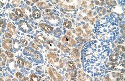 Immunohistochemistry-Paraffin: SLC22A16 Antibody [NBP1-60040]