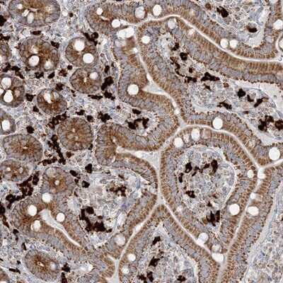 Immunohistochemistry-Paraffin: SLC22A16 Antibody [NBP1-85410]