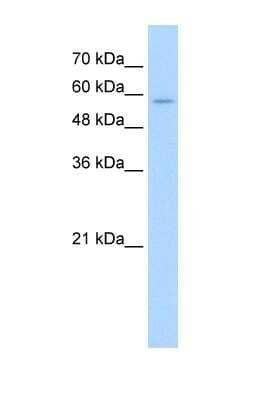 Western Blot: SLC22A16 Antibody [NBP1-60040]