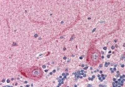 Immunohistochemistry-Paraffin: SLC22A17 Antibody [NBP1-20975]
