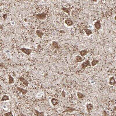 Immunohistochemistry-Paraffin: SLC22A17 Antibody [NBP1-88554]