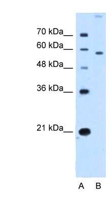 Western Blot: SLC22A2/OCT2 Antibody [NBP1-59451]