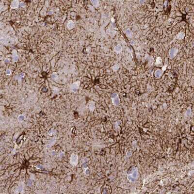 Immunohistochemistry-Paraffin: SLC22A2/OCT2 Antibody (CL0628) [NBP2-52941]