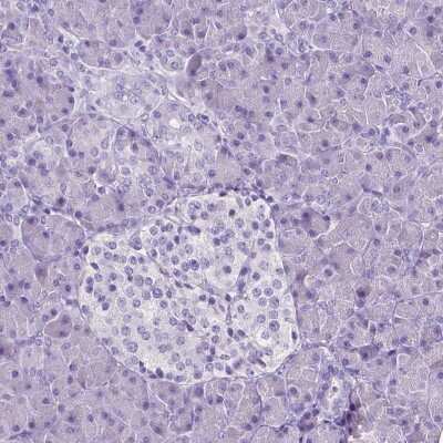 Immunohistochemistry-Paraffin: SLC22A2/OCT2 Antibody (CL0628) [NBP2-52941]