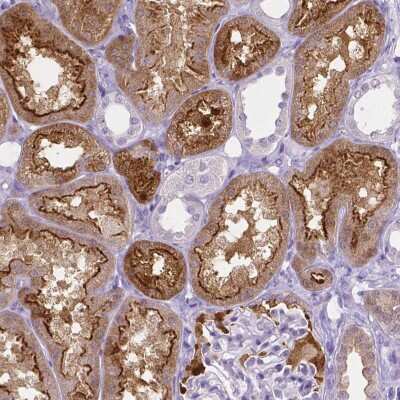 Immunohistochemistry-Paraffin: SLC22A2/OCT2 Antibody (CL0631) [NBP2-52942]