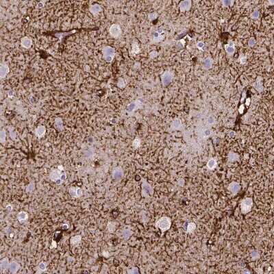 Immunohistochemistry-Paraffin: SLC22A2/OCT2 Antibody (CL0631) [NBP2-52942]