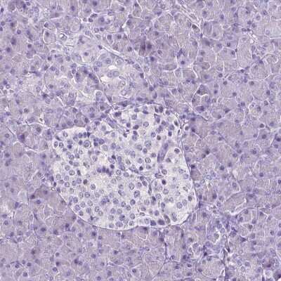 Immunohistochemistry-Paraffin: SLC22A2/OCT2 Antibody (CL0631) [NBP2-52942]