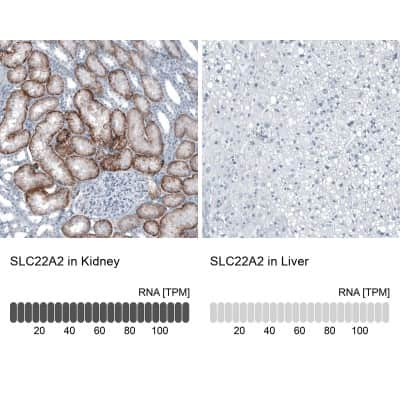 Immunohistochemistry-Paraffin: SLC22A2/OCT2 Antibody [NBP1-89417]