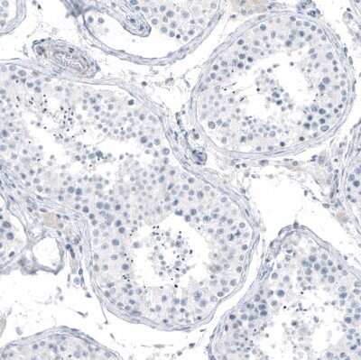 Immunohistochemistry-Paraffin: SLC22A2/OCT2 Antibody [NBP1-89417]