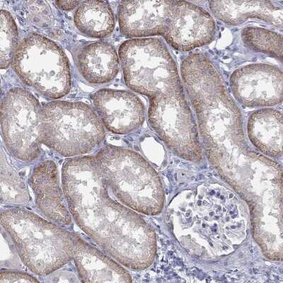 Immunohistochemistry-Paraffin: SLC22A2/OCT2 Antibody [NBP3-17065]
